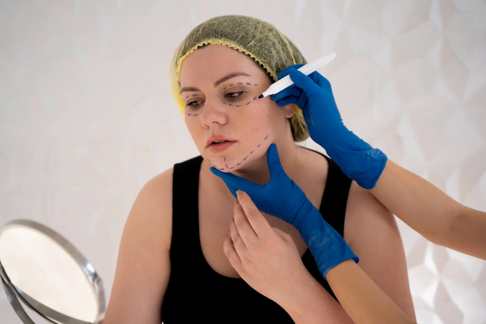 Non-Ablative-Skin-Resurfacing